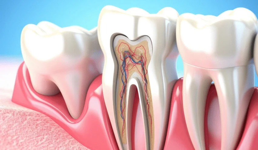 Root Canal Treatment
